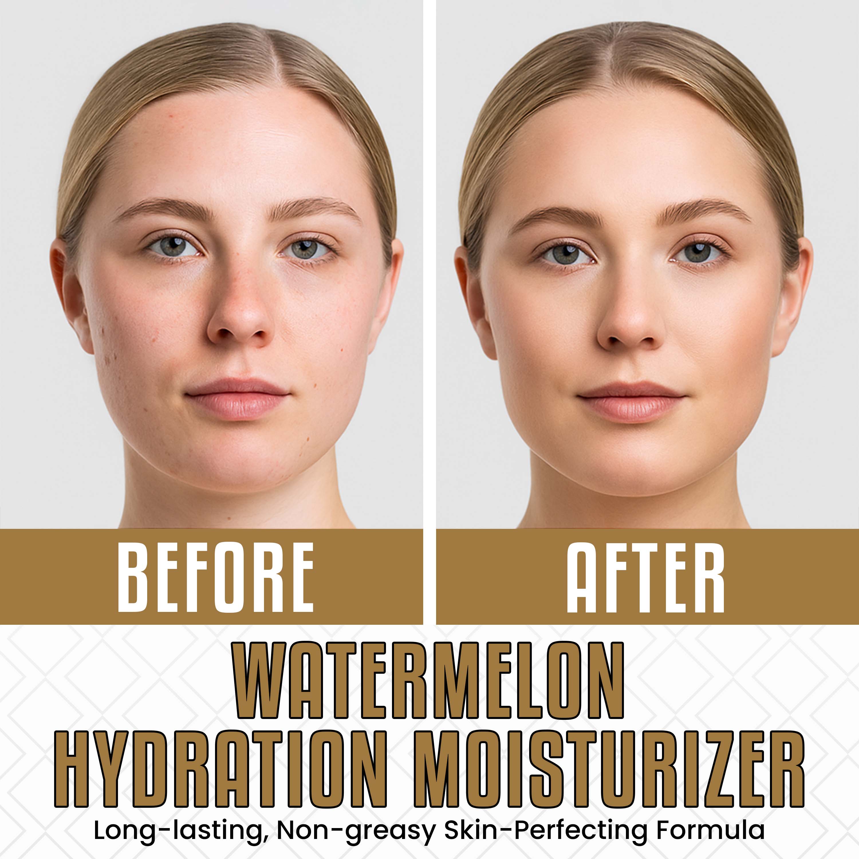 MyCern Watermelon Hydration Moisturizer