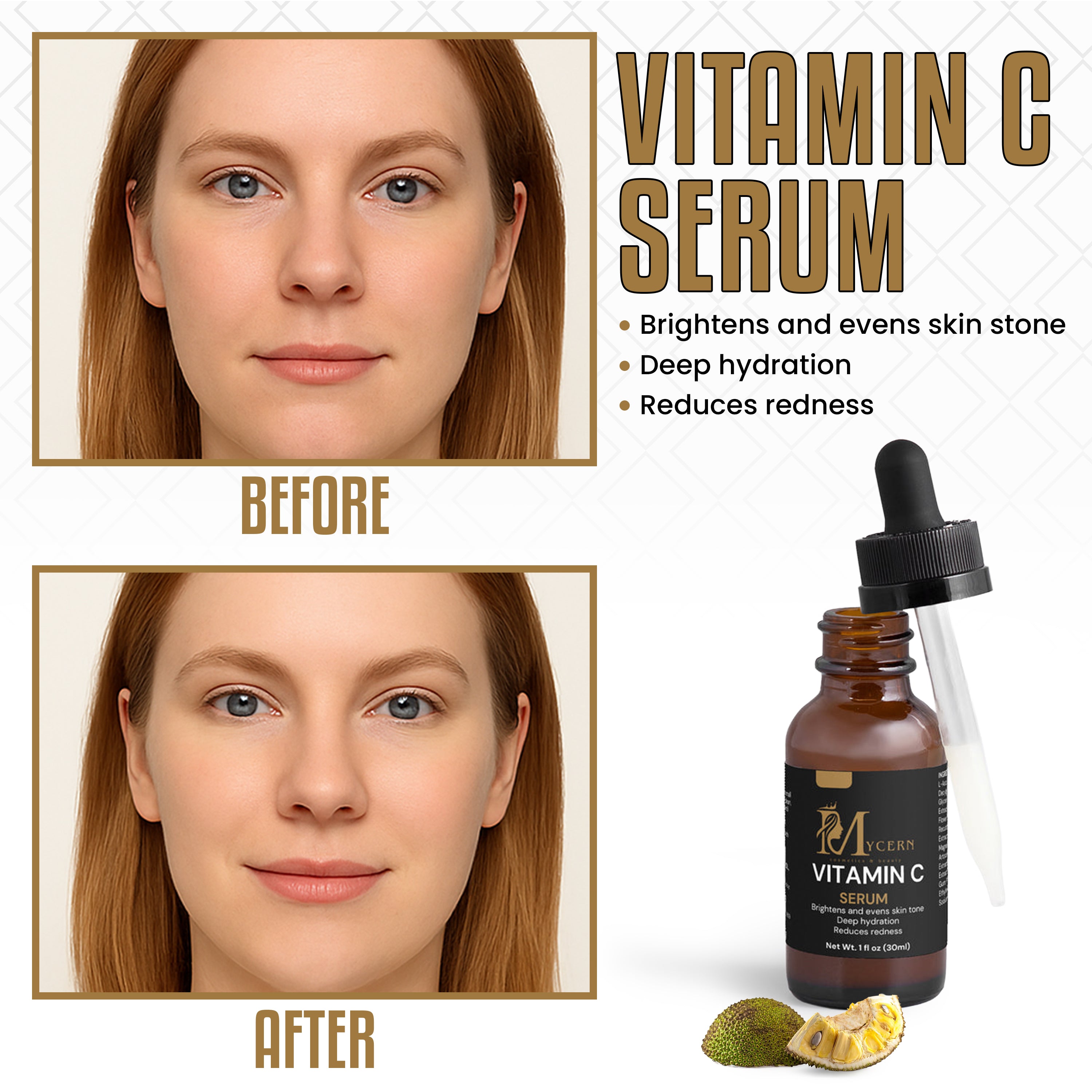 MyCern Vitamin C Serum
