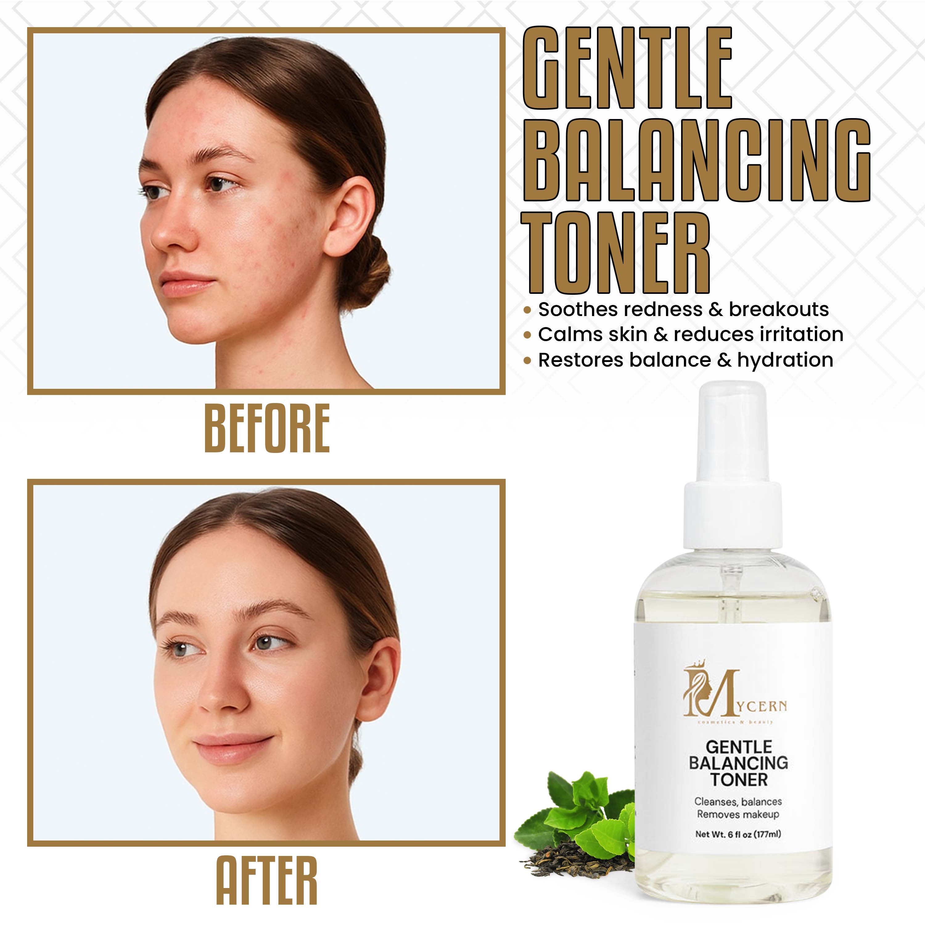 MyCern Gentle Cleansing Toner