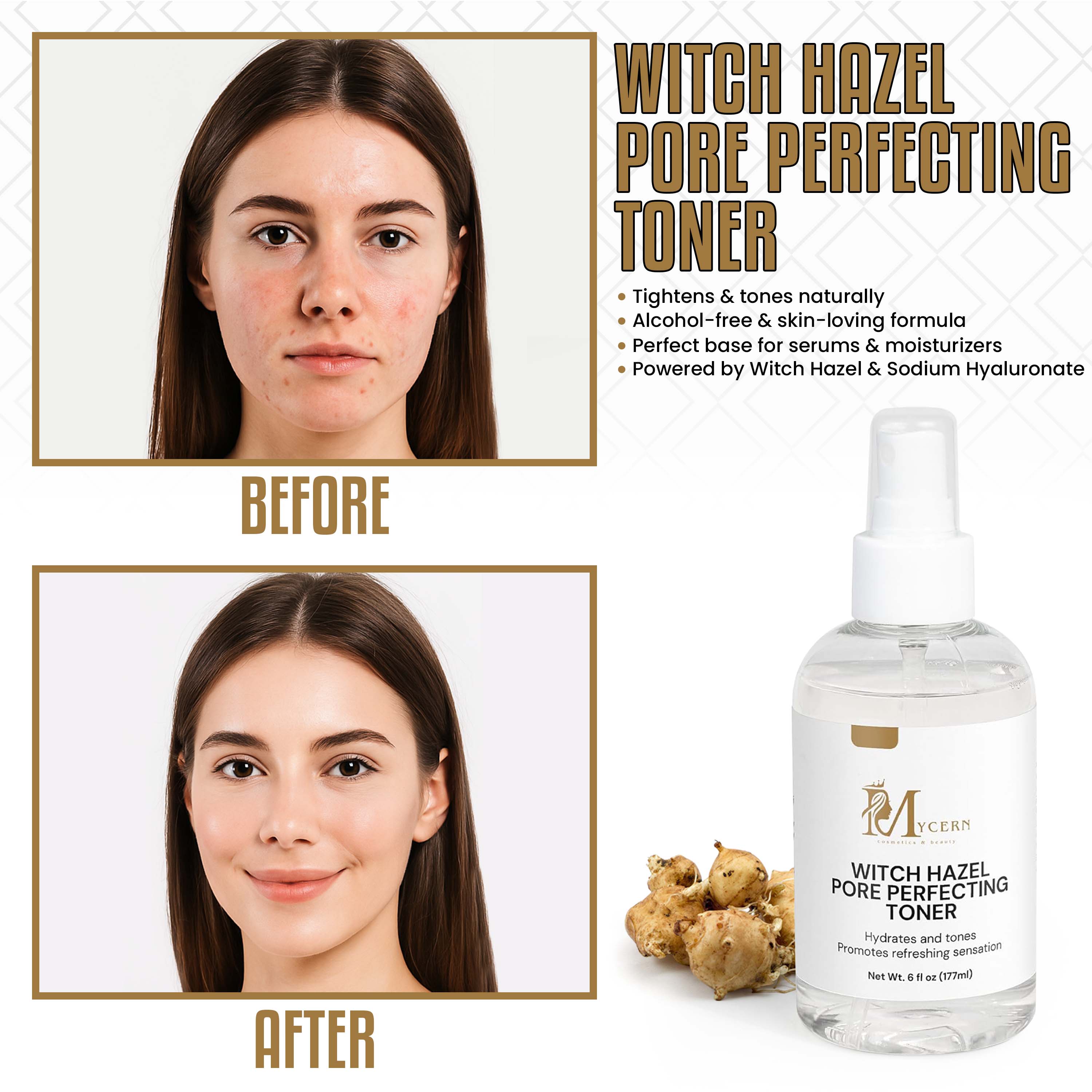 MyCern Witch Hazel Pore Perfecting Toner